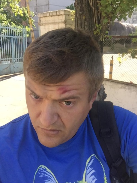 В Херсоне был избит журналист издания Мост