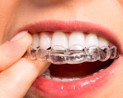Трансформувальний вплив зубних елайнерів